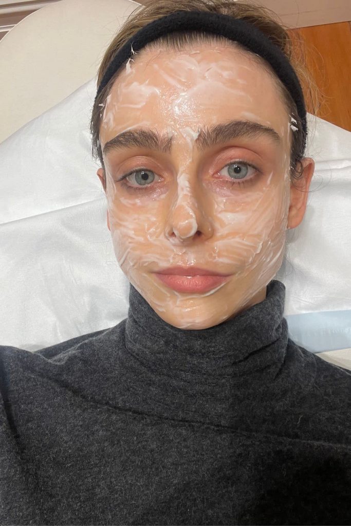 RF Microneedling treatment with numbing cream applied