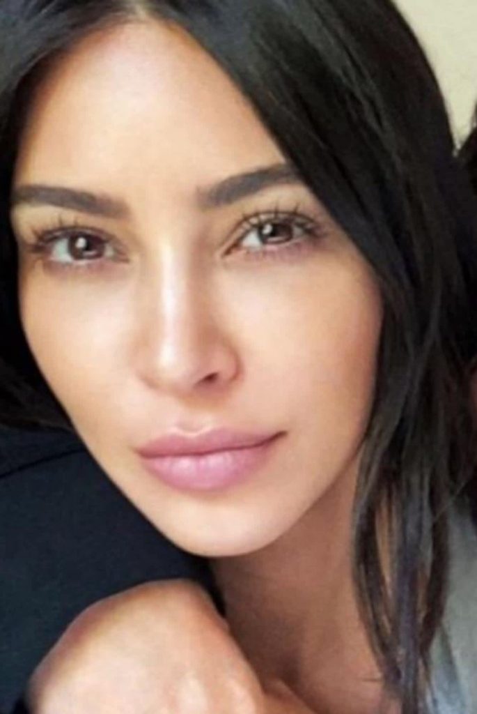 Wedding skincare timeline: Twice married Kim Kardashian is a huge fan of collagen induction therapy 